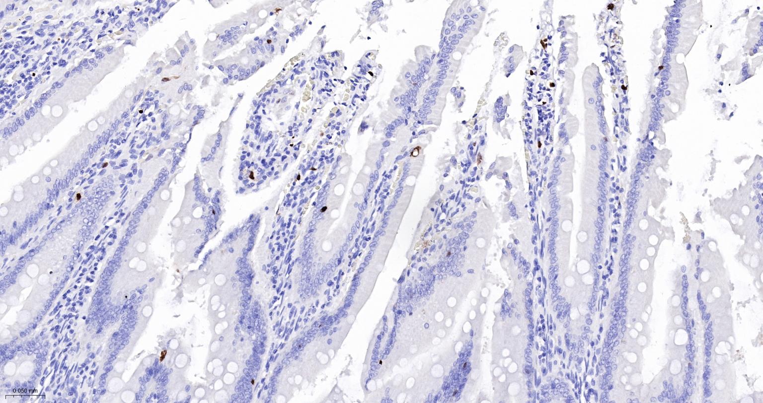 S100钙结合蛋白A8重组兔单抗-bsm-61167R