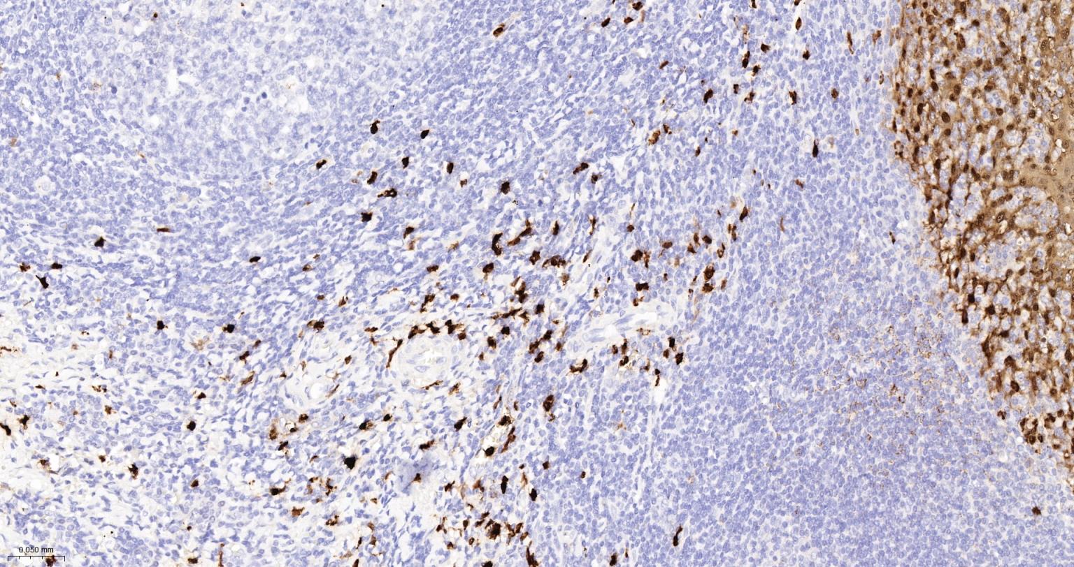 S100钙结合蛋白A8重组兔单抗-bsm-61167R