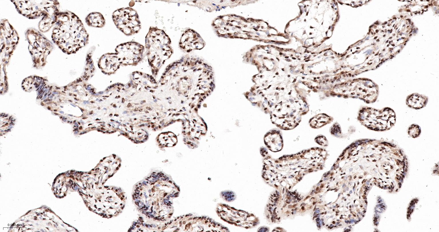 缺氧诱导因子1α抑制蛋白/HIF1AN重组兔单抗-bsm-61905R