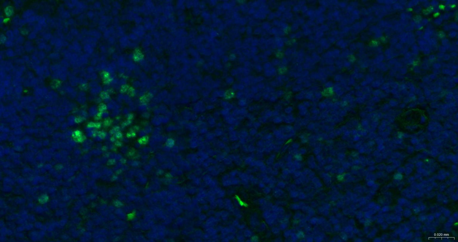 Ki67重组兔单抗-bsm-52455R