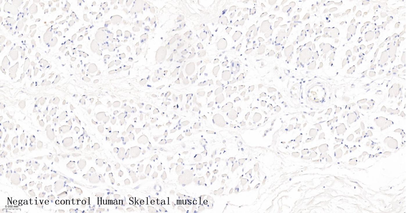 肾小球裂孔膜蛋白PDCN重组兔单抗-bsm-63061R
