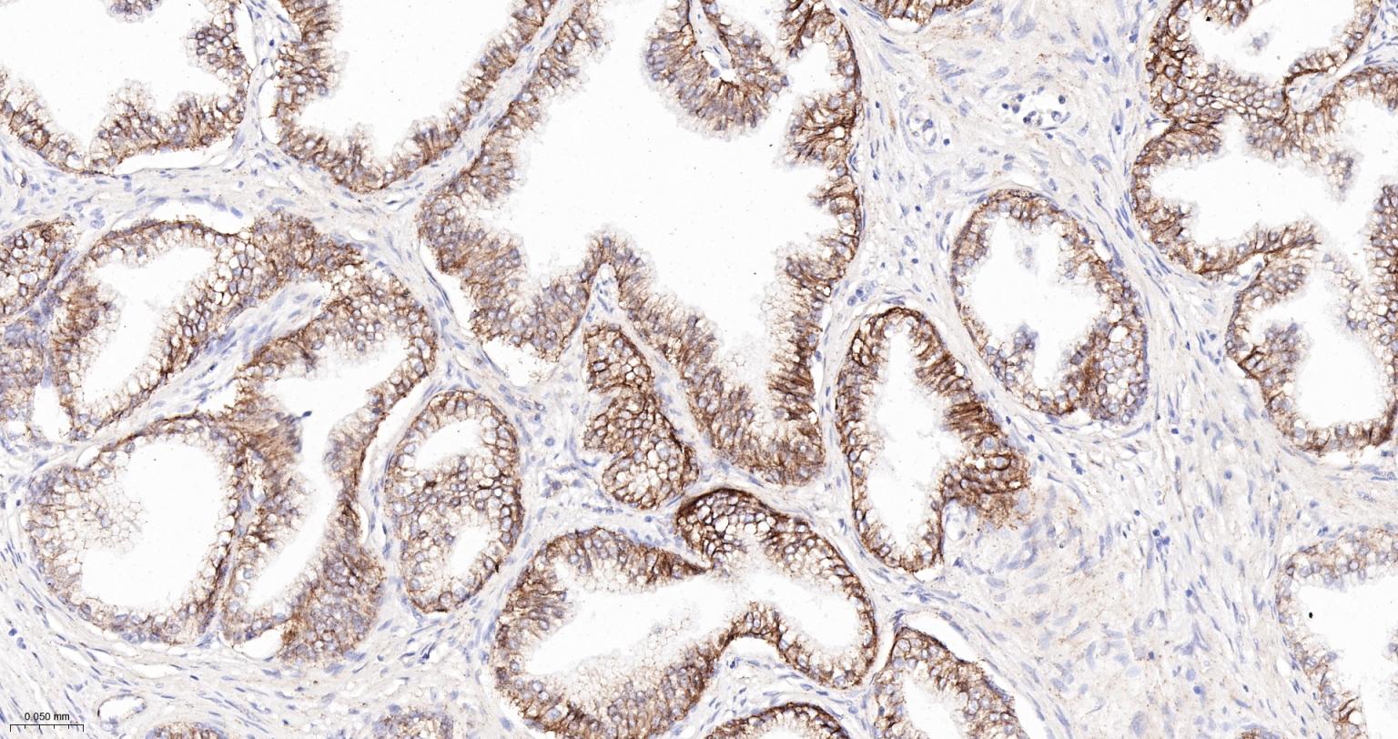 连环蛋白delta-1重组兔单抗-bsm-60229R