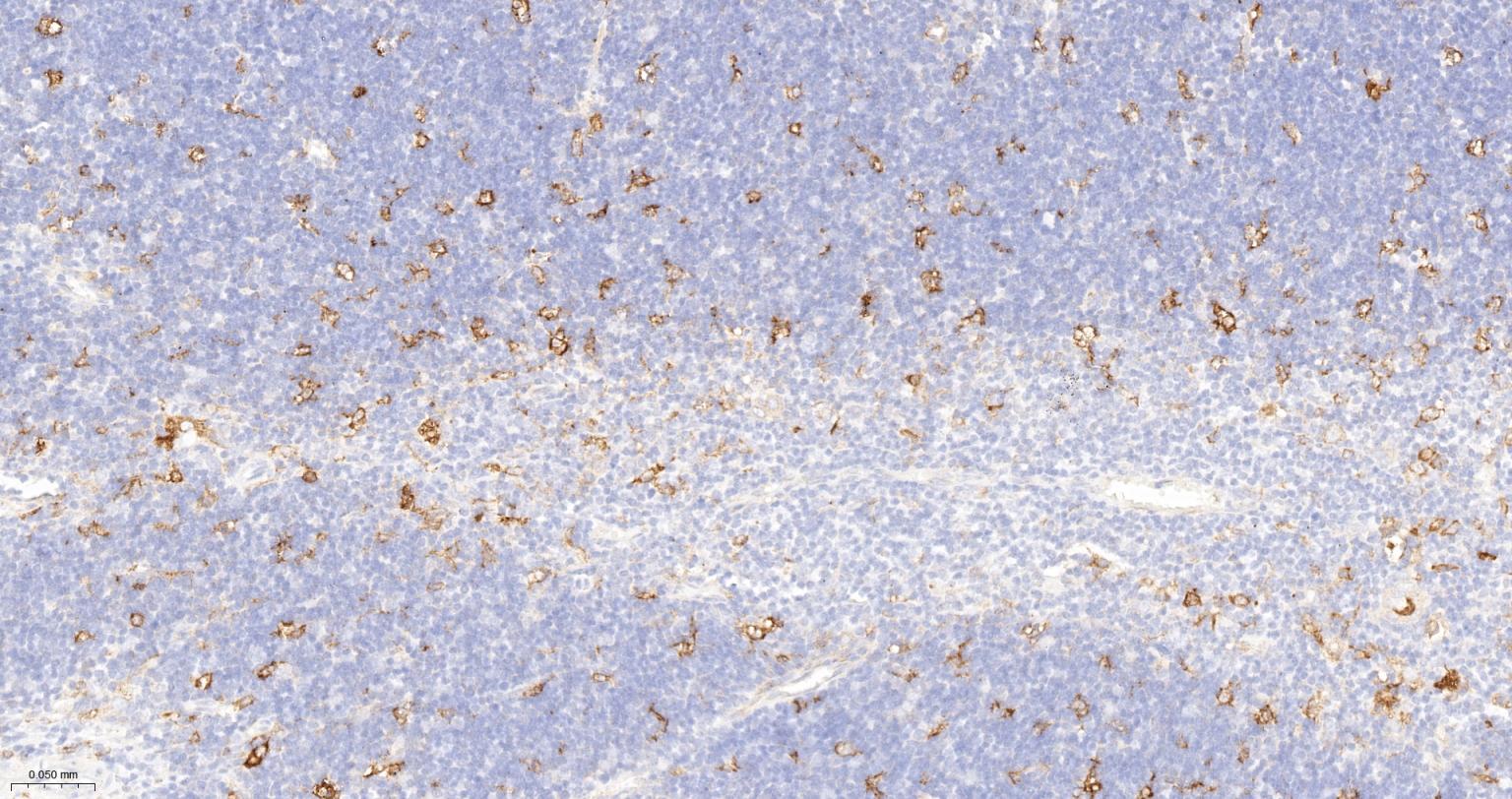 血红素氧合酶 1抗体-bsm-60751R