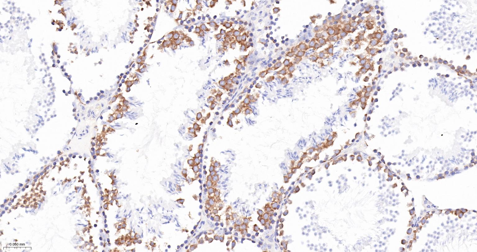TACC3重组兔单抗-bsm-61119R