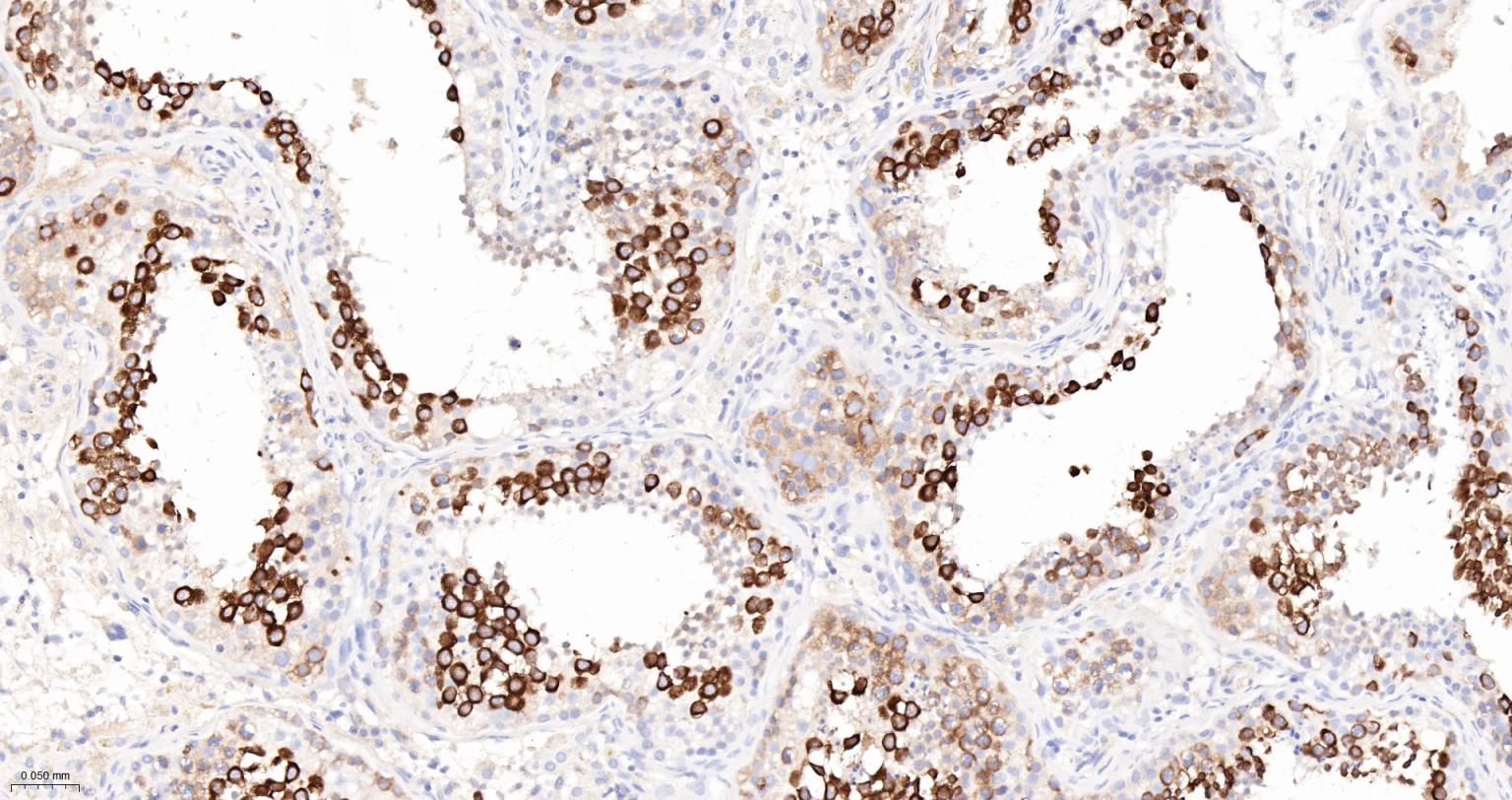 TACC3重组兔单抗-bsm-61119R