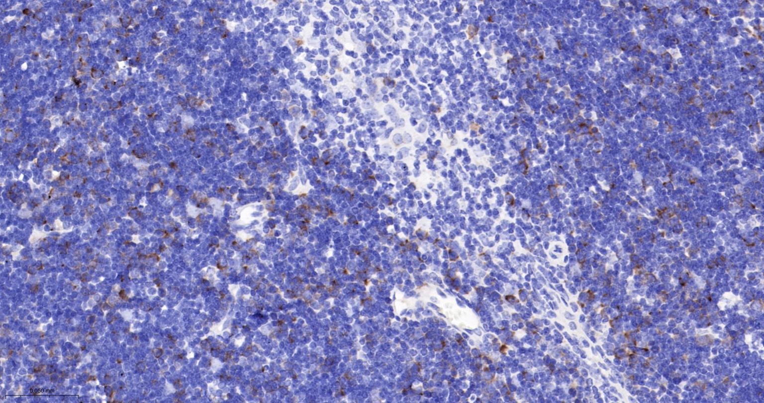 TACC3重组兔单抗-bsm-61119R