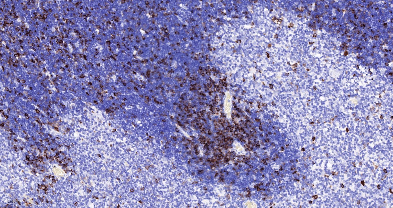 TACC3重组兔单抗-bsm-61119R