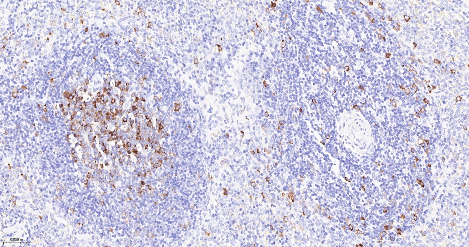 TACC3重组兔单抗-bsm-61119R