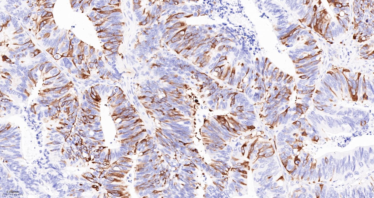 TACC3重组兔单抗-bsm-61119R