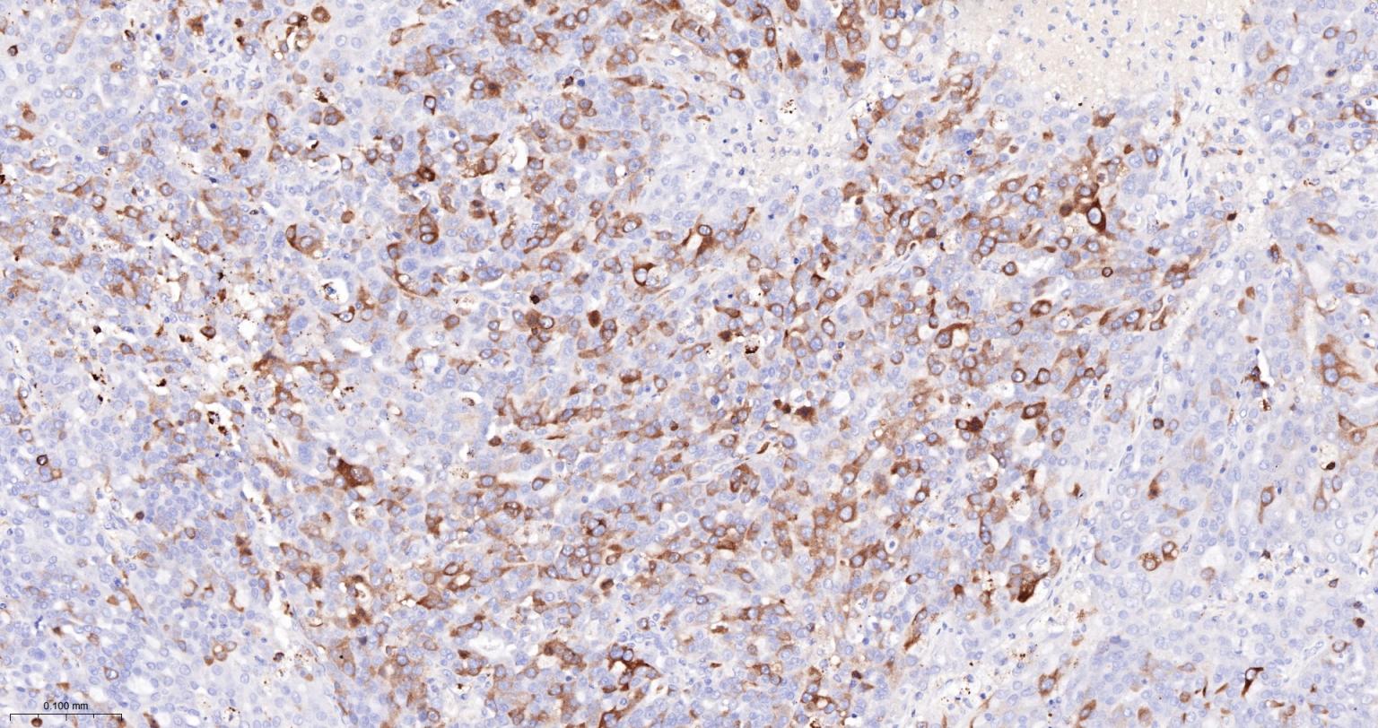 TACC3重组兔单抗-bsm-61119R
