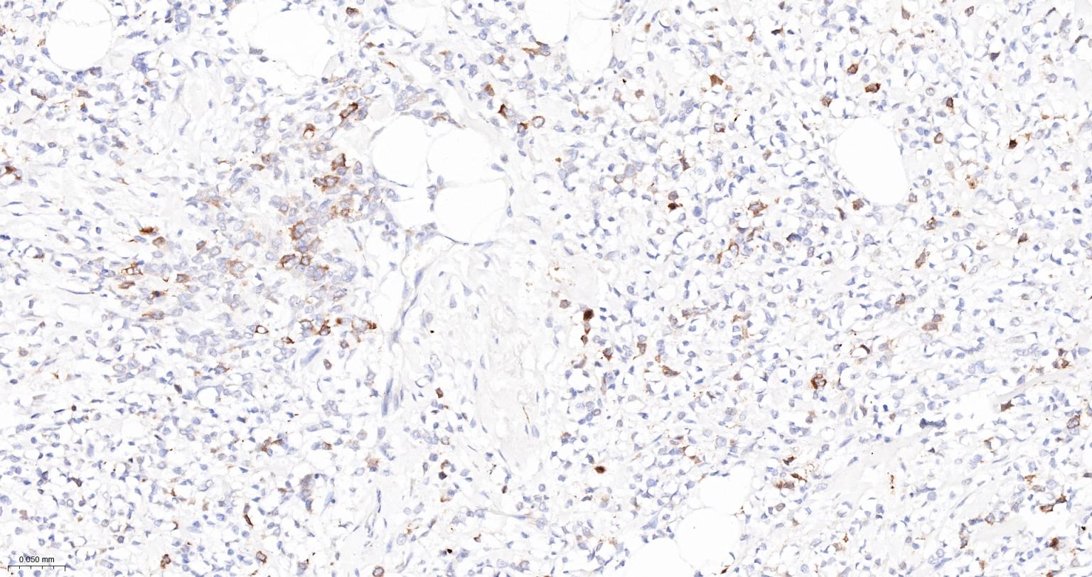 TACC3重组兔单抗-bsm-61119R