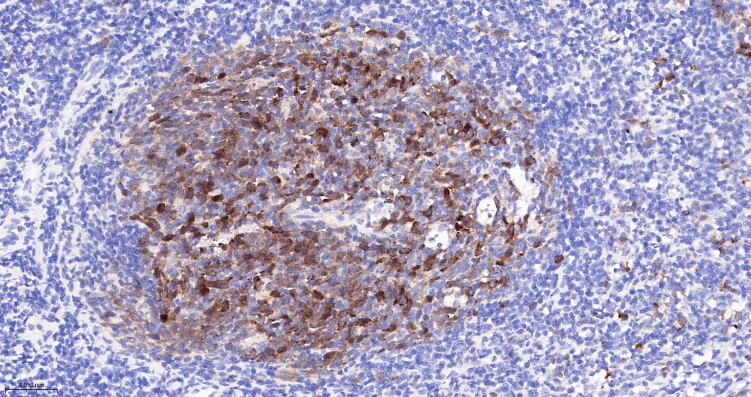 TACC3重组兔单抗-bsm-61119R