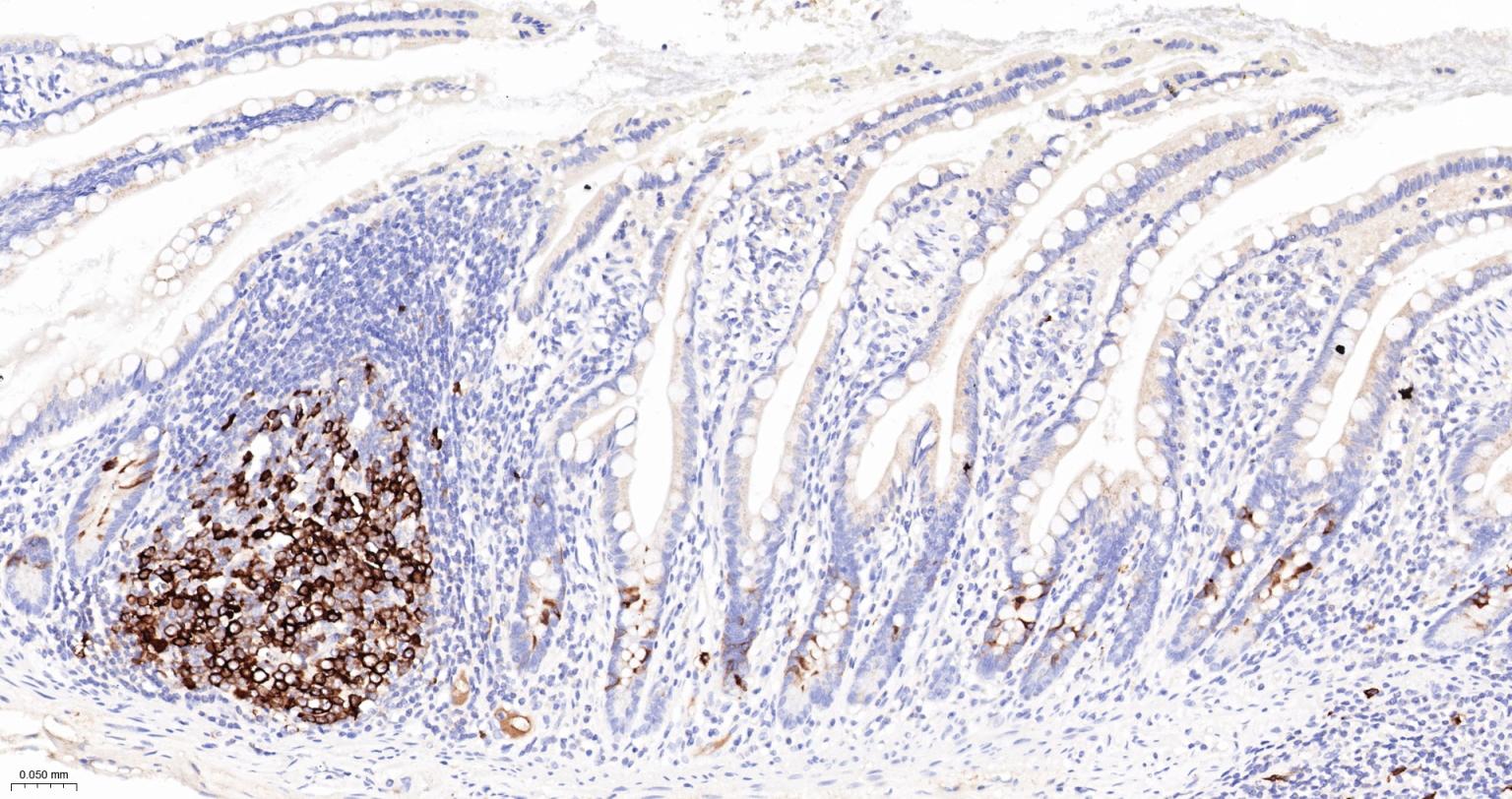 TACC3重组兔单抗-bsm-61119R