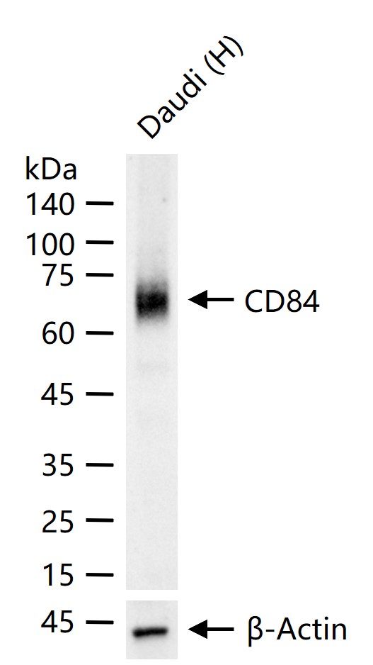 CD84重组兔单抗-bsm-62503R
