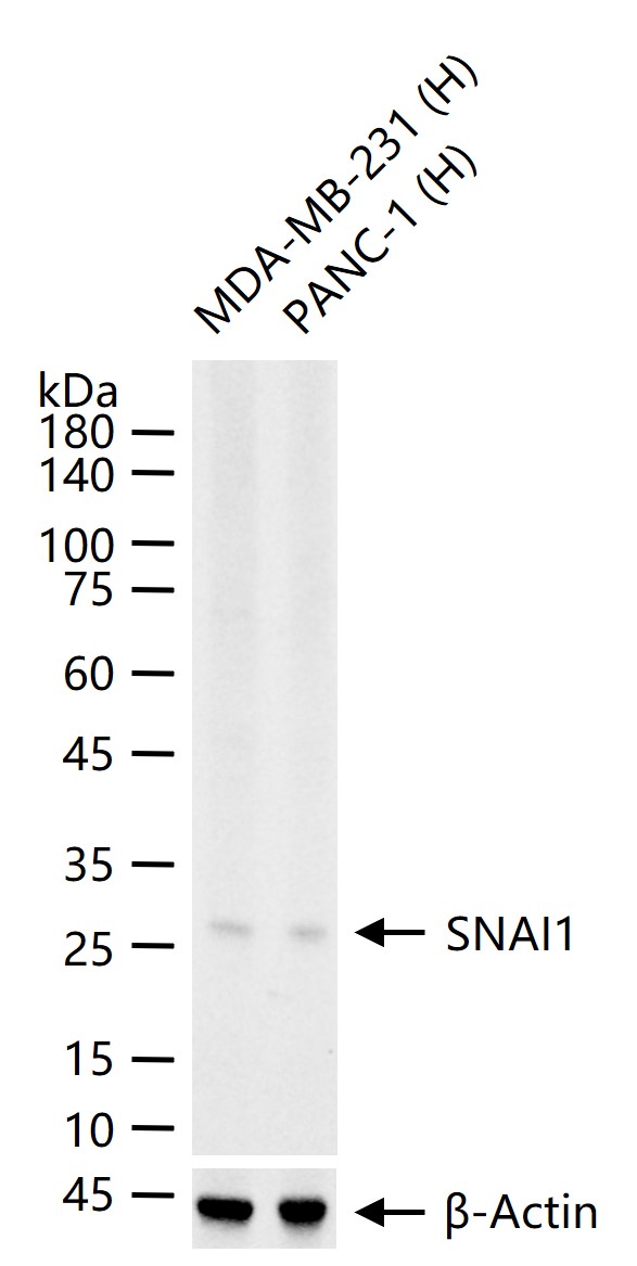 SNAI1蛋白重组兔单抗-bsm-60947R