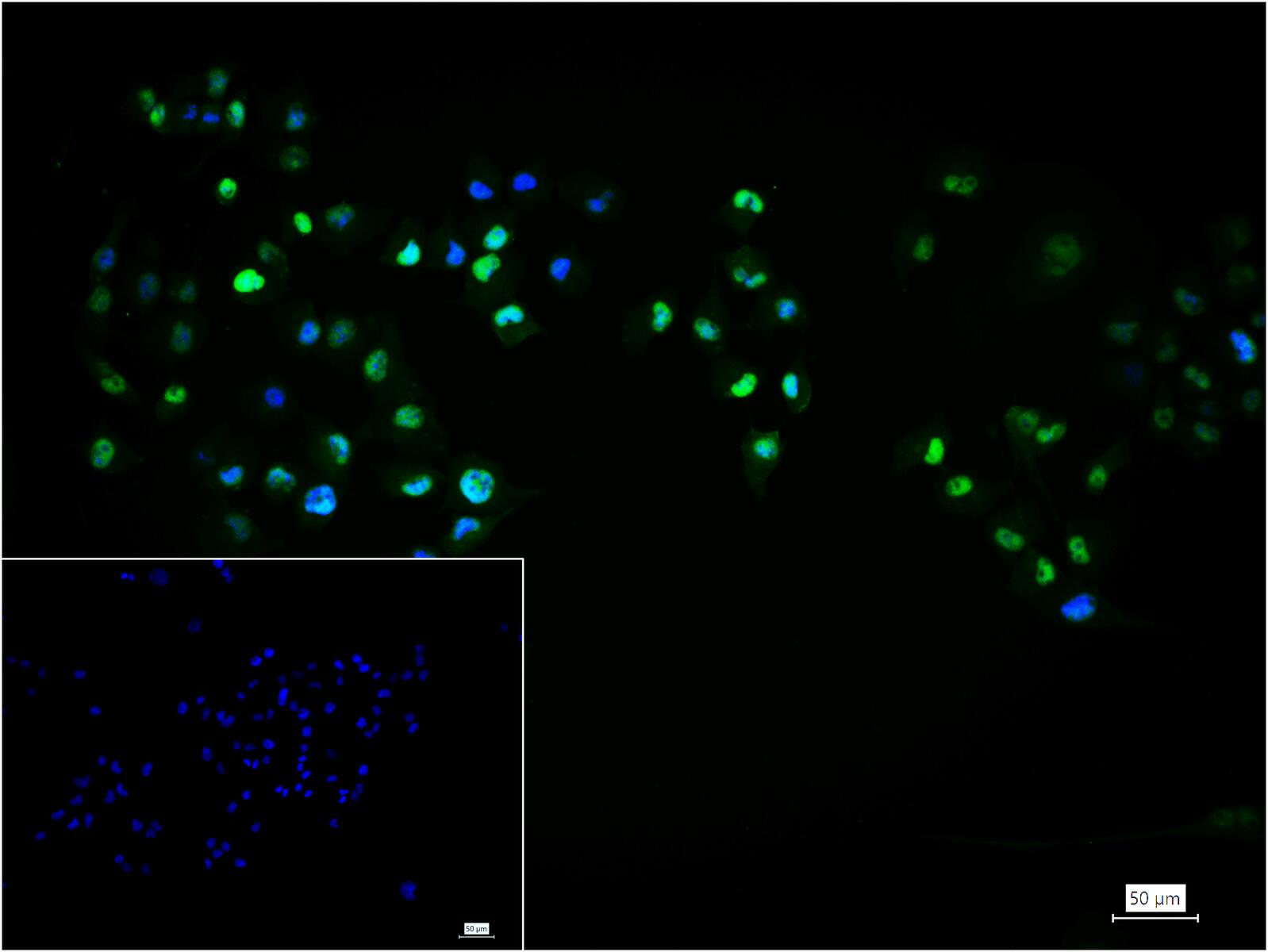 转录因子SOX9蛋白重组兔单抗-bsm-63031R