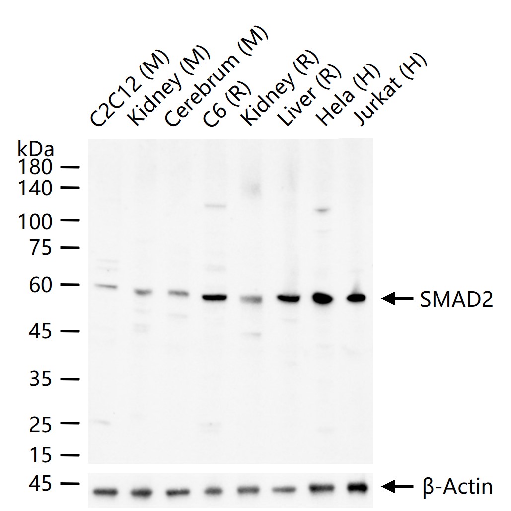 细胞信号转导分子Smad-2抗体-bs-0718R