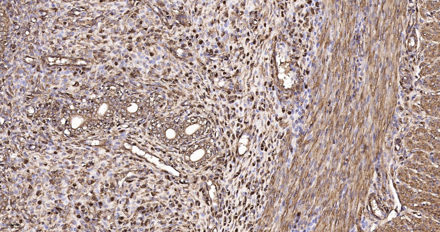 肌动蛋白α/α-SMA/α Actin抗体-bs-10196R