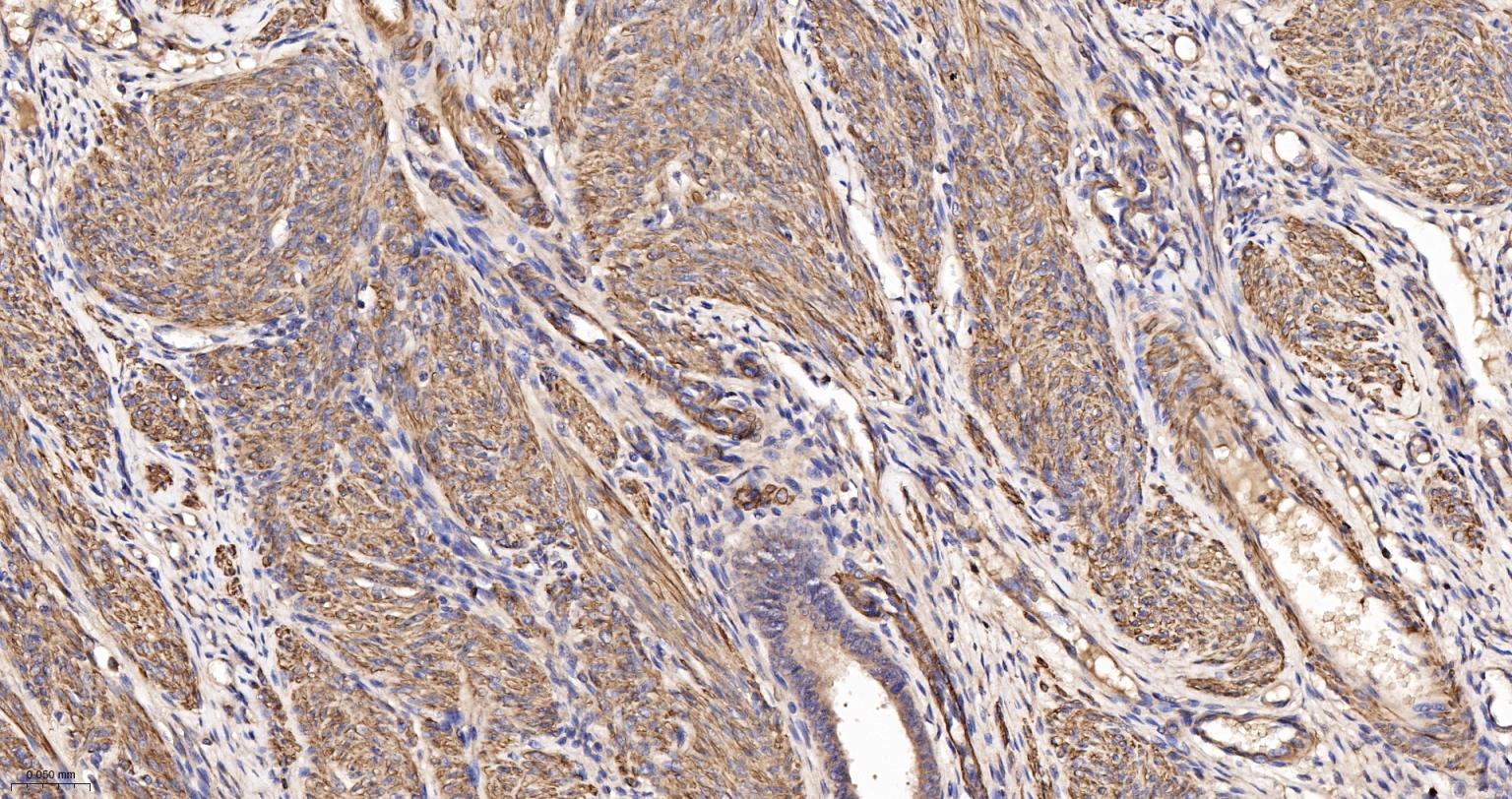 肌动蛋白α/α-SMA/α Actin抗体-bs-10196R