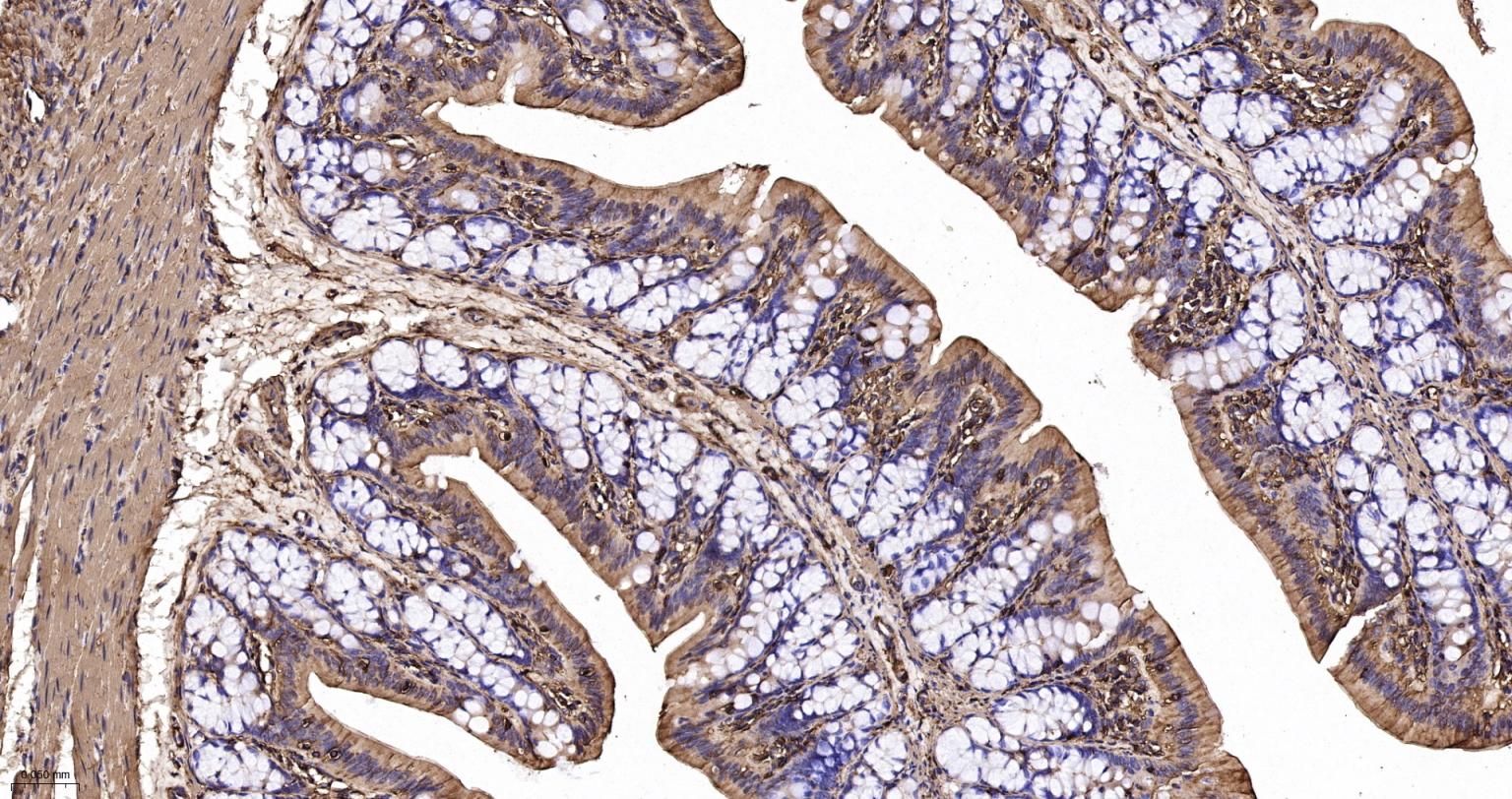 肌动蛋白α/α-SMA/α Actin抗体-bs-0189R