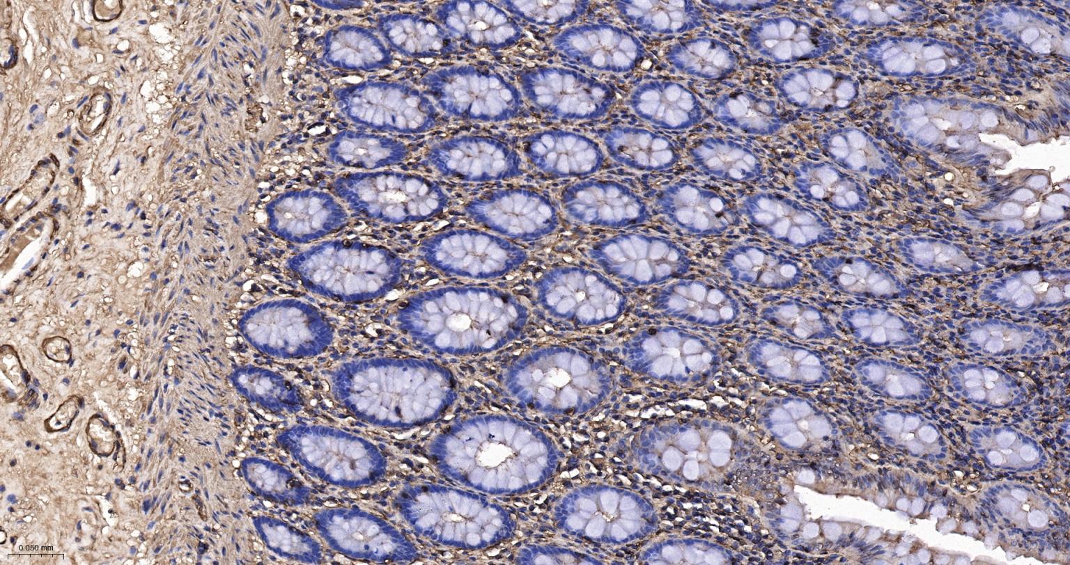 肌动蛋白α/α-SMA/α Actin抗体-bs-0189R