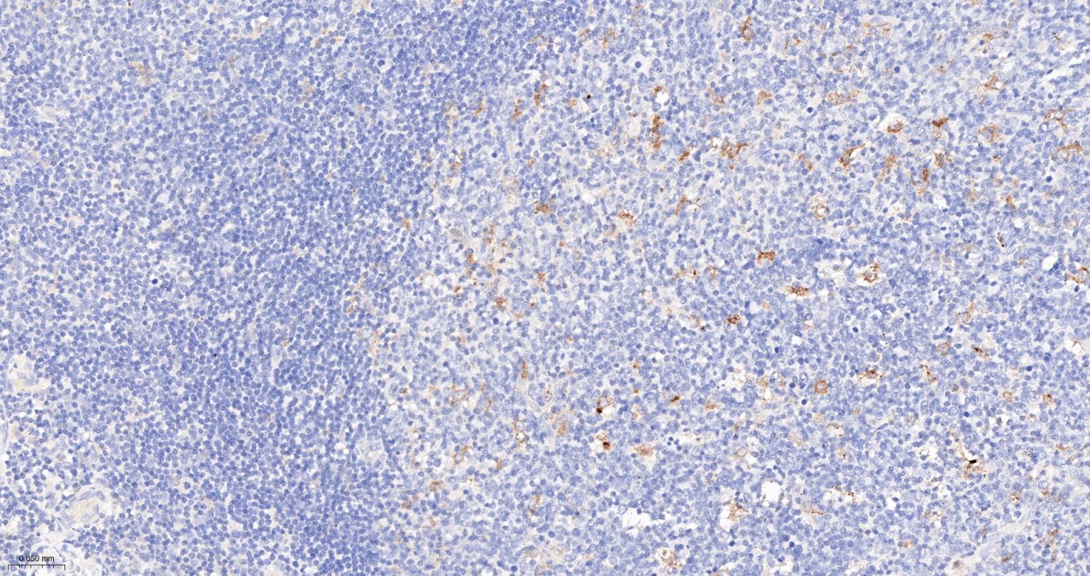 白介素1β/IL-1β单克隆抗体-bsm-55644M