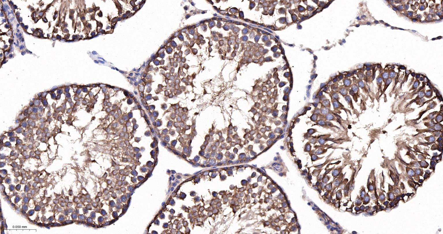 微管蛋白α/Tubulin α/α-tubulin单克隆抗体-bsm-33039M