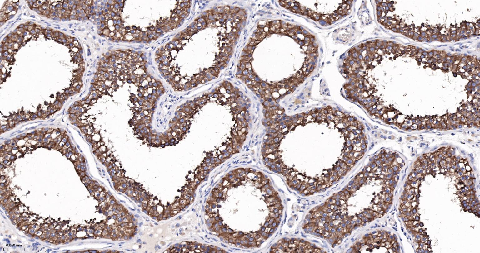 微管蛋白α/Tubulin α/α-tubulin单克隆抗体-bsm-33039M