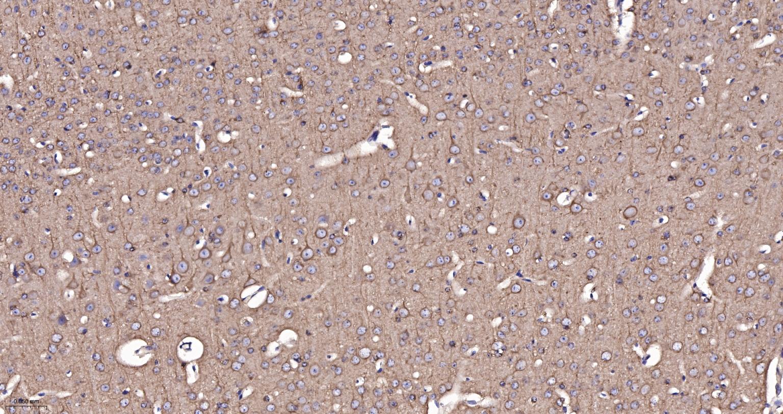 微管蛋白α/Tubulin α/α-tubulin单克隆抗体-bsm-33039M