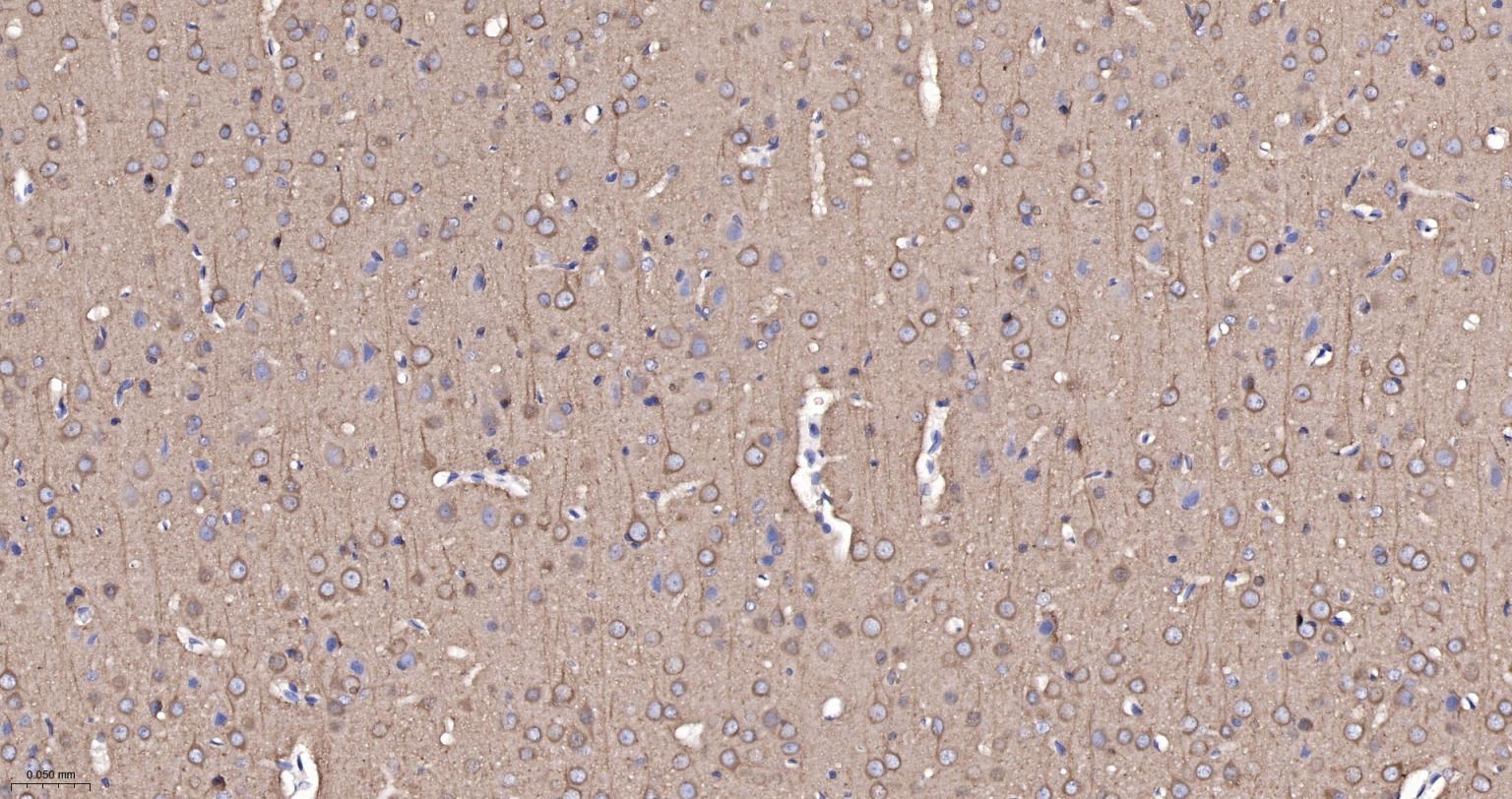 微管蛋白α/Tubulin α/α-tubulin单克隆抗体-bsm-33039M