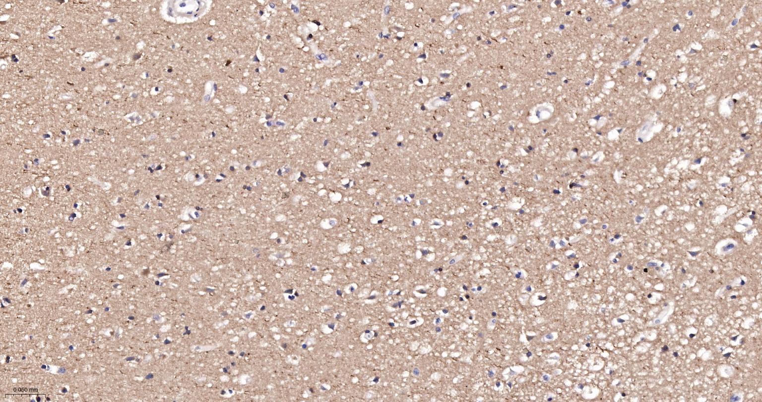 微管蛋白α/Tubulin α/α-tubulin单克隆抗体-bsm-33039M