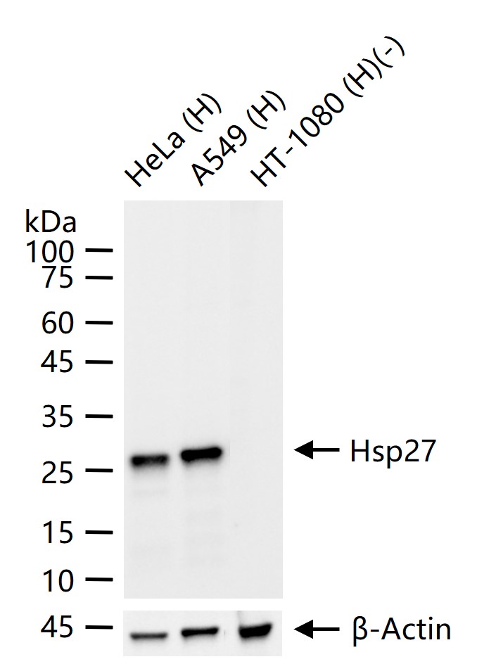 热休克蛋白27重组兔单抗-bsm-52757R