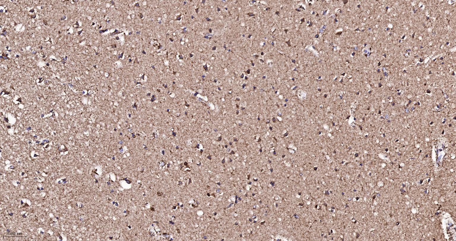热休克蛋白-60/groEL重组兔单抗-bsm-61183R
