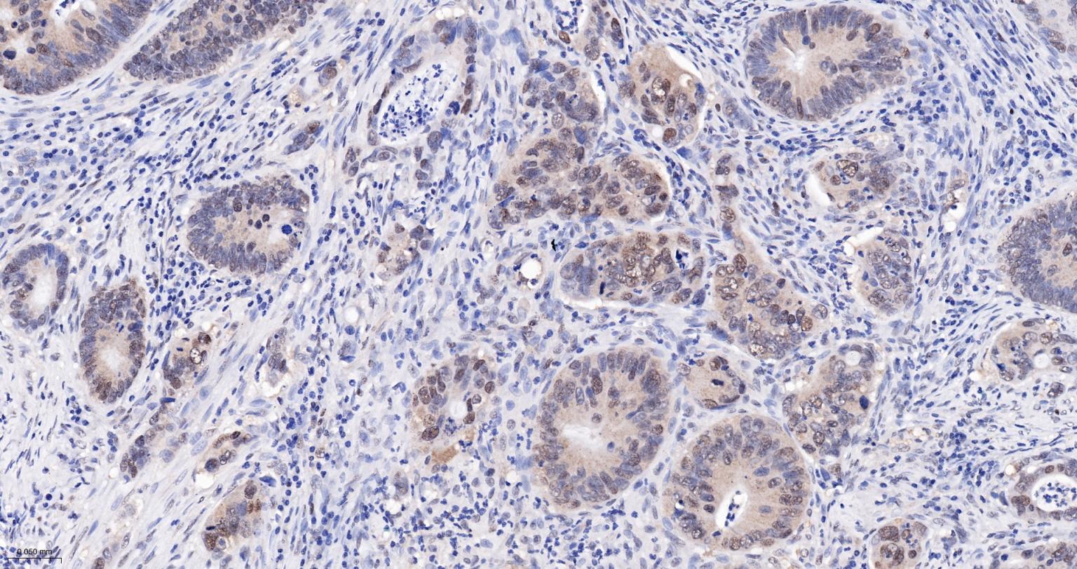 热休克蛋白-60/groEL重组兔单抗-bsm-61183R