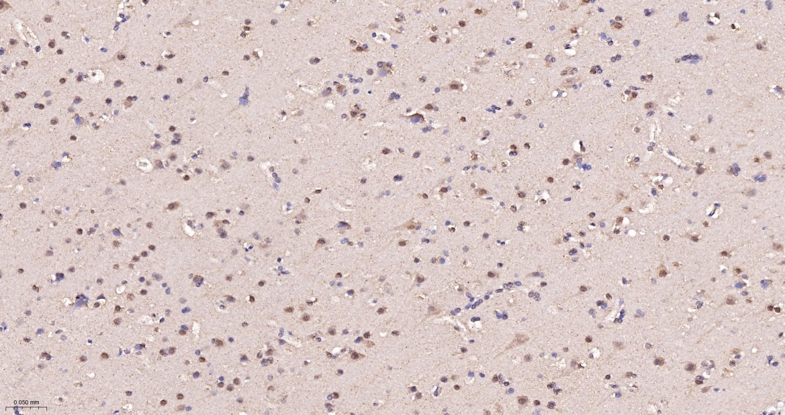 热休克蛋白-60/groEL重组兔单抗-bsm-61183R
