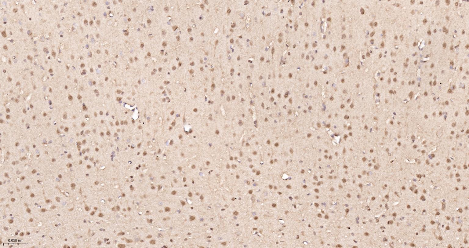 泛素蛋白重组兔单抗-bsm-63008R