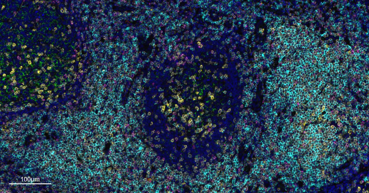 CD4重组兔单抗-bsm-52469R
