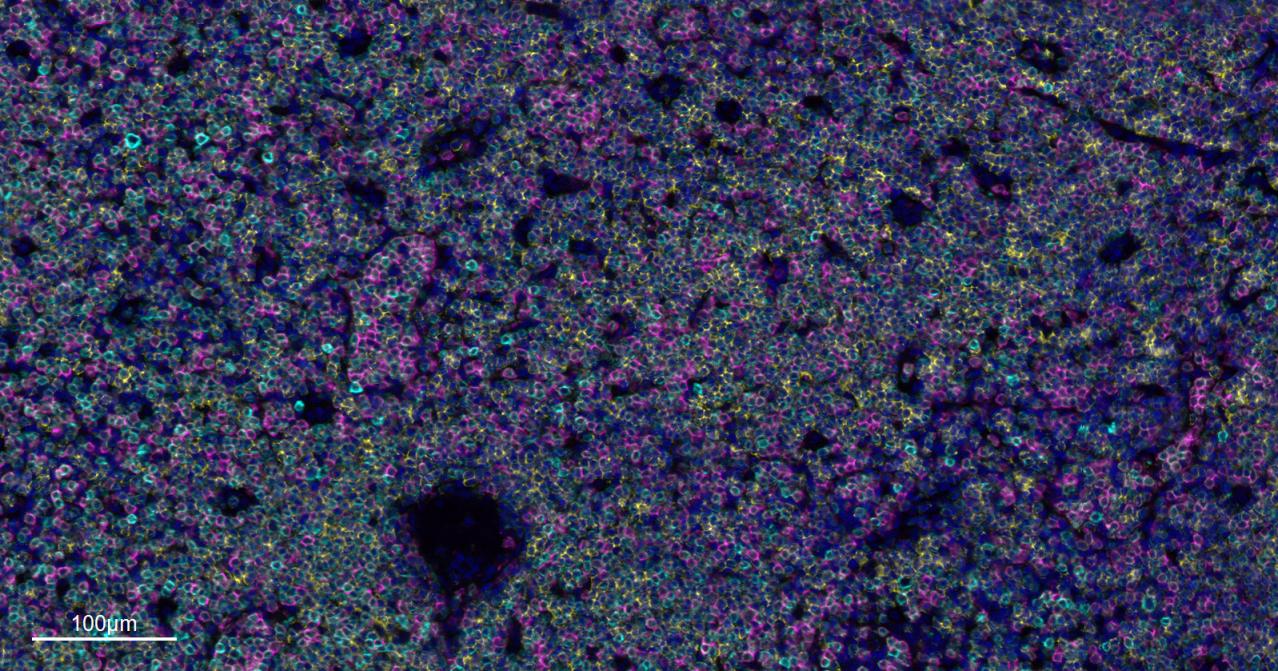 CD4重组兔单抗-bsm-52469R