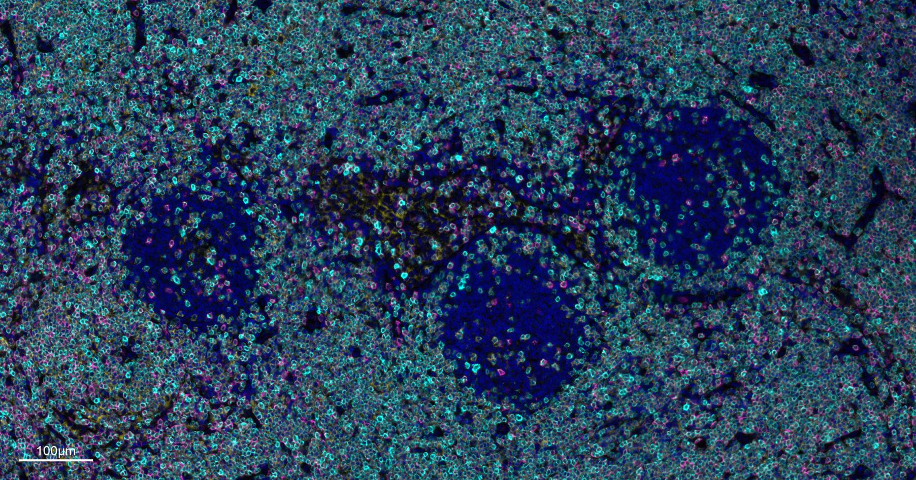 CD3/CD3-ε重组兔单抗-bsm-60002R