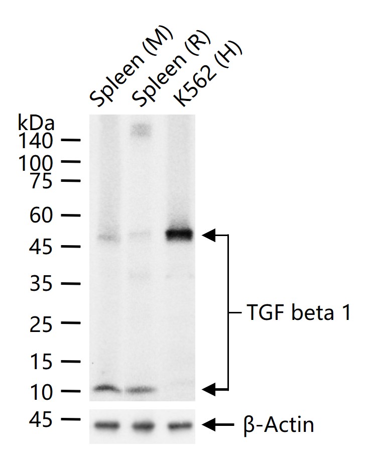 转化生长因子β1重组兔单抗-bsm-61027R