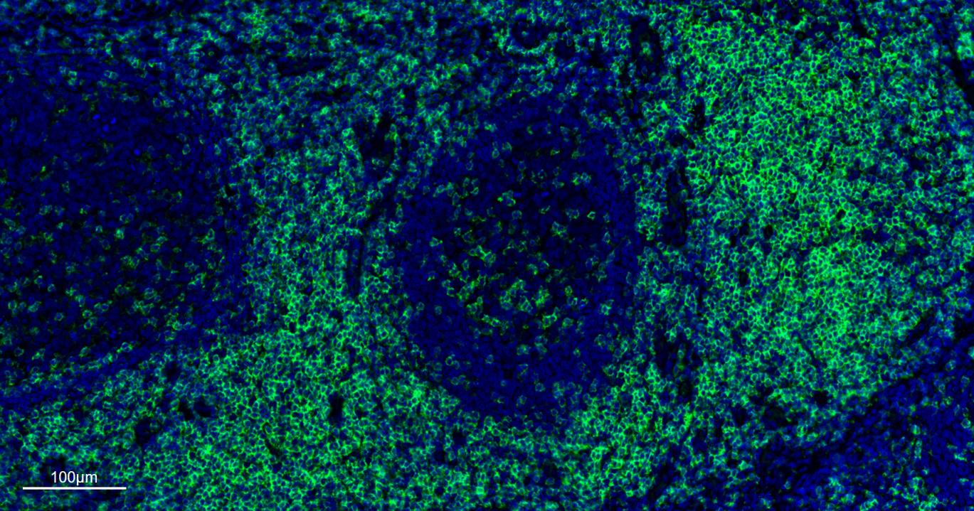 CD4重组兔单抗-bsm-52469R