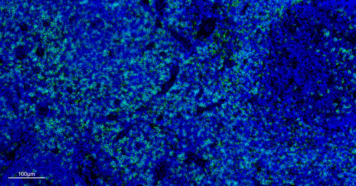 CD4重组兔单抗-bsm-52469R