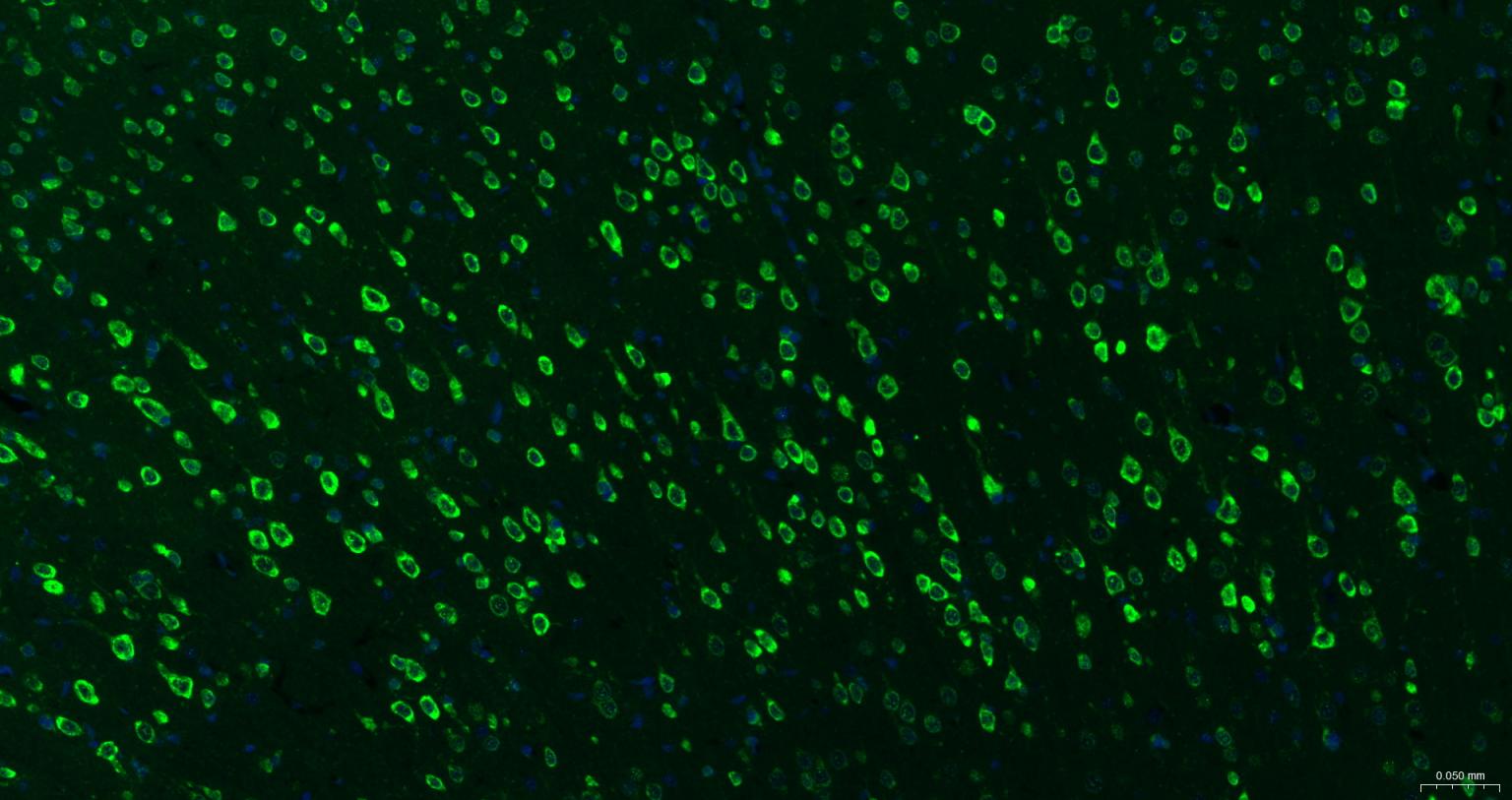 糖原合酶激酶-3β重组兔单抗-bsm-63070R