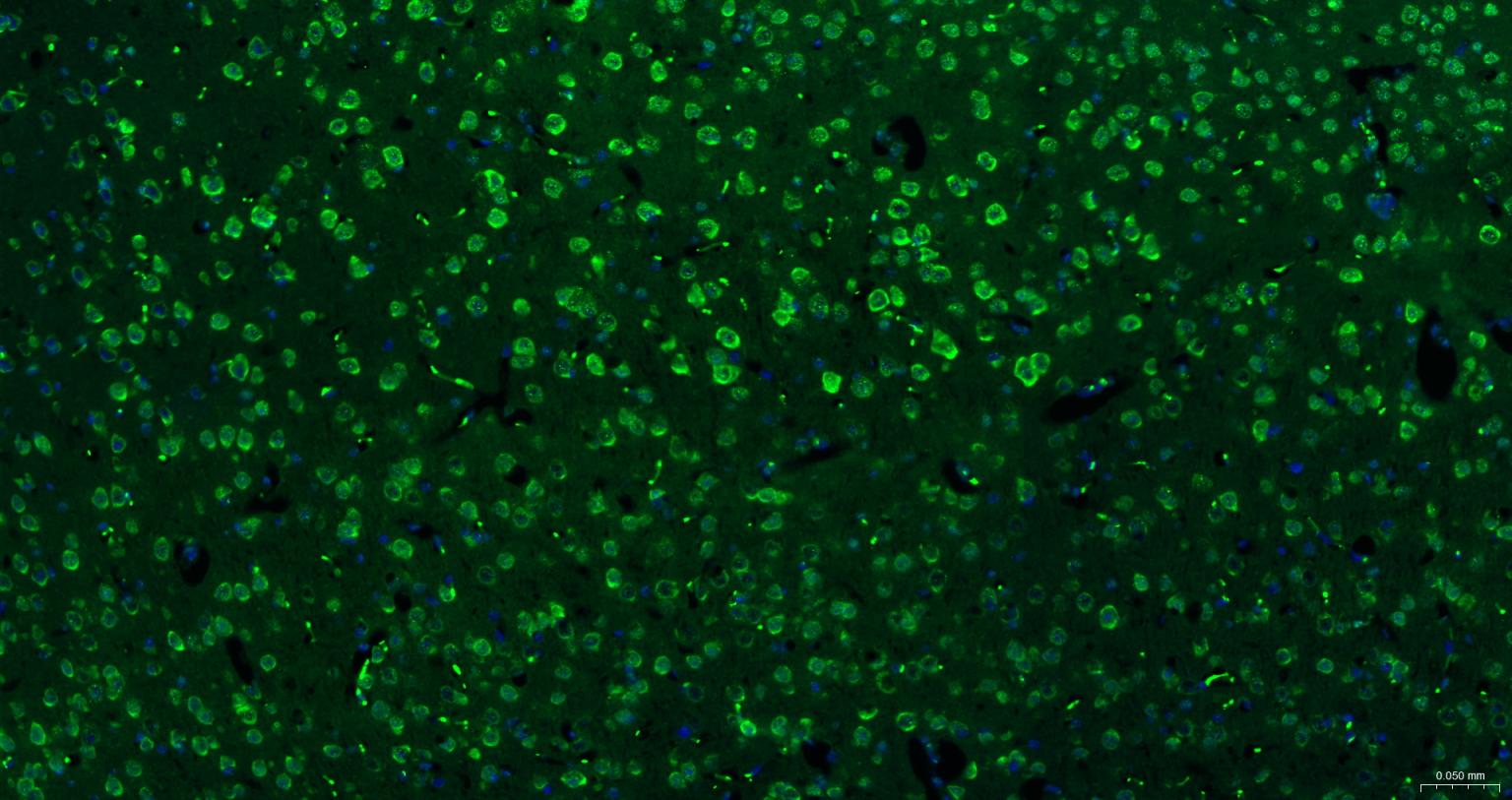 糖原合酶激酶-3β重组兔单抗-bsm-63070R