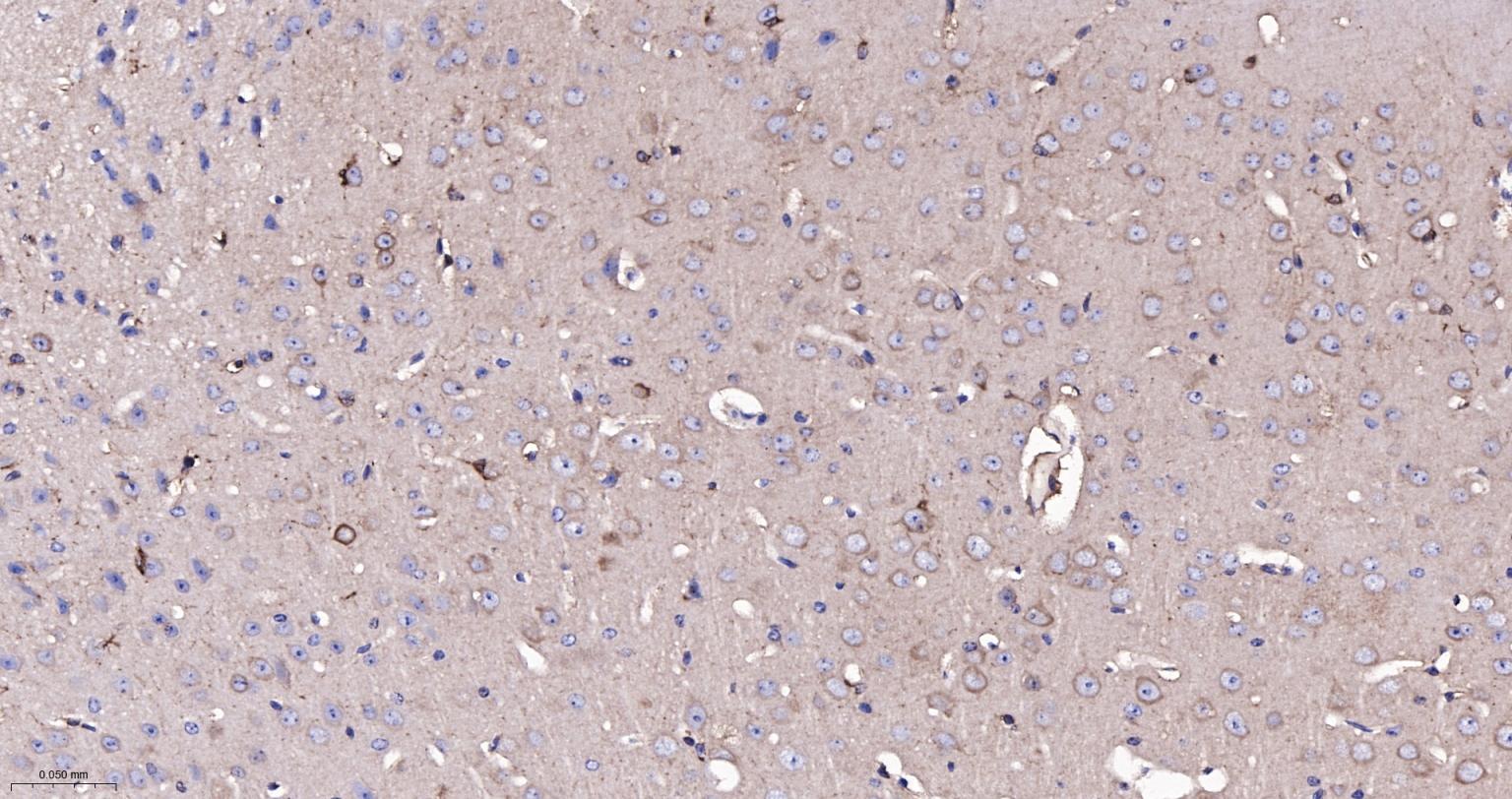 成纤维细胞生长因子21重组兔单抗-bsm-52978R