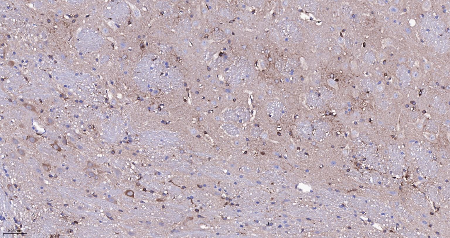 成纤维细胞生长因子21重组兔单抗-bsm-52978R