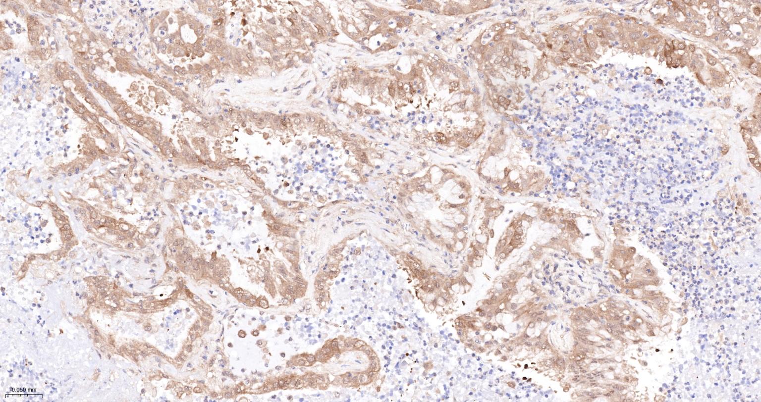 转铁蛋白受体（CD71）抗体-bsm-54633R