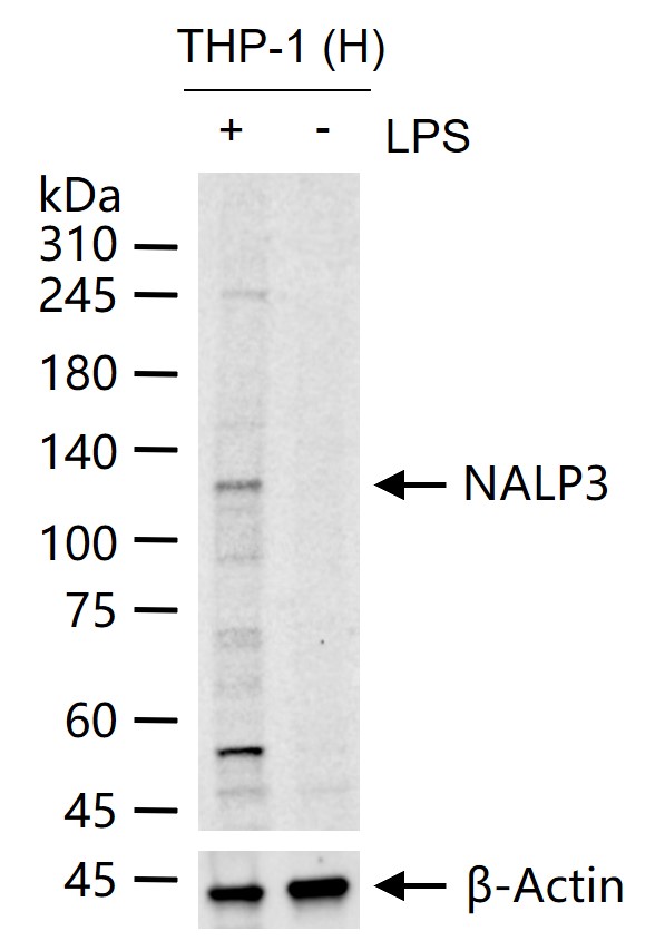 细胞凋亡诱导蛋白NALP3抗体-bs-25913R