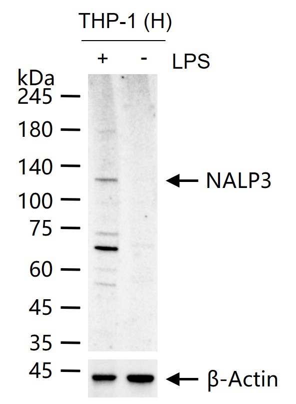 细胞凋亡诱导蛋白NALP3抗体-bs-25914R