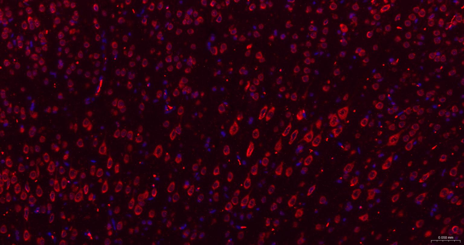 糖原合酶激酶-3β重组兔单抗-bsm-63070R